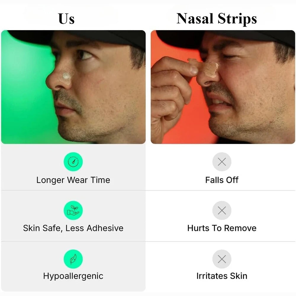 Flowstate - Nasal Strips